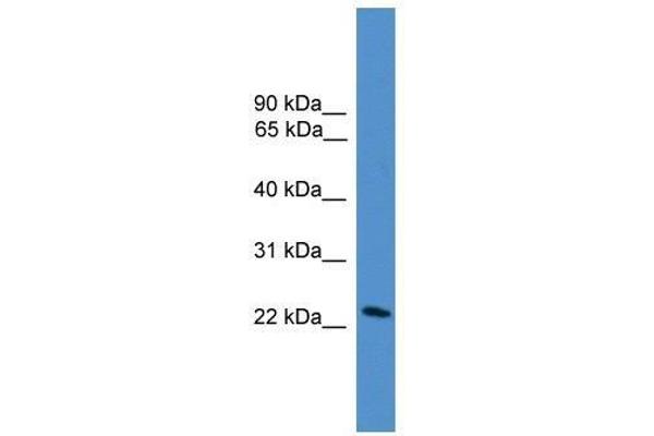 DGAT2L7P anticorps  (C-Term)