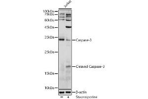 Western blot analysis of extracts of Jurkat cells, using Caspase-3 antibody (ABIN6131582, ABIN6137962, ABIN6137964 and ABIN6215049) at 1:1000 dilution. (Caspase 3 anticorps  (AA 55-160))