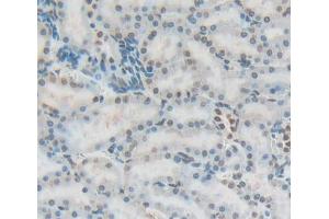 Used in DAB staining on fromalin fixed paraffin- embedded Kidney tissue (Fibrillarin anticorps  (AA 85-274))