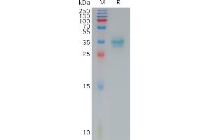 Human C(145-157) Protein, hFc Tag on SDS-PAGE under reducing condition. (Claudin 4 Protein (CLDN4) (AA 145-157) (Fc Tag))