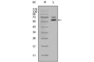 Western Blot showing CK5 antibody used against Hela cell lysate (1). (Cytokeratin 5 anticorps)