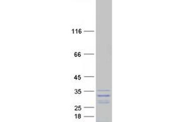 GAR1 Protein (Transcript Variant 1) (Myc-DYKDDDDK Tag)