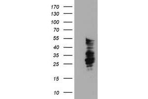 HEK293T cells were transfected with the pCMV6-ENTRY control (Left lane) or pCMV6-ENTRY SERPINB2 (Right lane) cDNA for 48 hrs and lysed. (SERPINB2 anticorps)