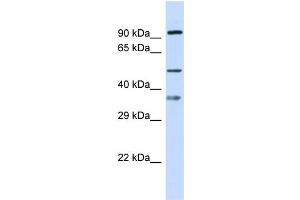 Host: Rabbit Target Name: SGSH Sample Type: 721_B Whole Cell lysates Antibody Dilution: 1. (SGSH anticorps  (N-Term))