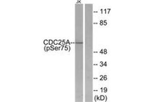 Western blot analysis of extracts from Jurkat cells treated with UV, using CDC25A (Phospho-Ser75) Antibody. (CDC25A anticorps  (pSer76))