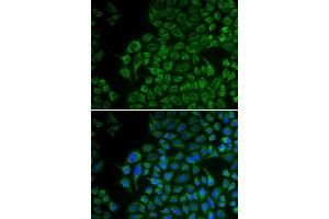 Immunofluorescence analysis of U2OS cells using TYR antibody. (TYR anticorps)