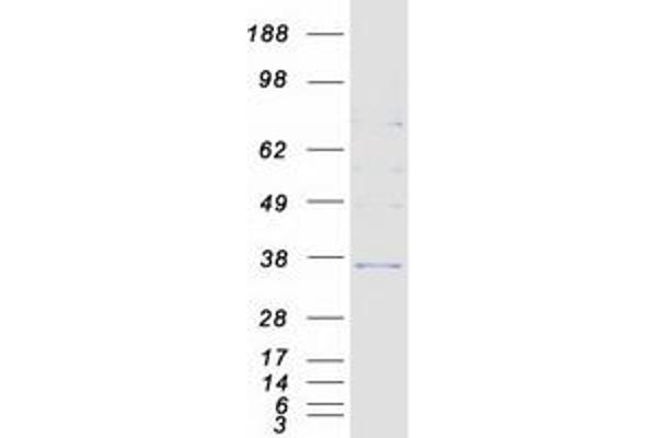 HSD17B6 Protein (Myc-DYKDDDDK Tag)