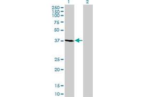 Western Blot analysis of FBXO2 expression in transfected 293T cell line by FBXO2 monoclonal antibody (M01), clone 1G4. (FBXO2 anticorps  (AA 1-296))