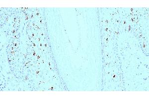 Human skin: immunohistochemical staining for langerin. (CD207 anticorps)