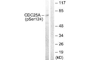 Western blot analysis of extracts from 293 cells, treated with UV (15mins), using CDC25A (Phospho-Ser124) antibody. (CDC25A anticorps  (pSer124))