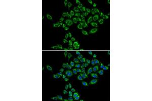 Immunofluorescence analysis of HeLa cells using SRPK1 antibody. (SRPK1 anticorps)