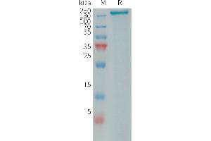 Human R1 Protein, His Tag on SDS-PAGE under reducing condition. (PLA2R1 Protein (AA 21-1397) (His tag))