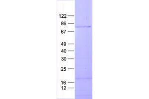 Validation with Western Blot (RIOK2 Protein (His tag))