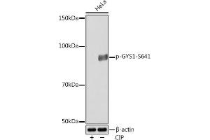 Western blot analysis of extracts of various cell lines, using Phospho-GYS1-S641 Rabbit mAb (ABIN7270761) at 1:1000 dilution. (Glycogen Synthase 1 anticorps  (pSer641))