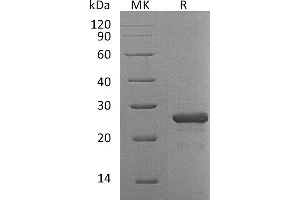 FGF19 Protein (His tag)