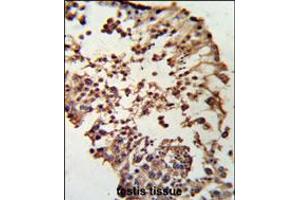 Formalin-fixed and paraffin-embedded human testis tissue reacted with RB1 Antibody , which was peroxidase-conjugated to the secondary antibody, followed by DAB staining. (Retinoblastoma 1 anticorps  (C-Term))