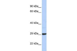 WB Suggested Anti-C10orf56 Antibody Titration: 0. (ZCCHC24 anticorps  (Middle Region))