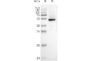 WB analysis of Human C-Nanodisc with anti-Flag monoclonal antibody at 1/5000 dilution, followed by Goat Anti-Rabbit IgG HRP at 1/5000 dilution (CXCR3 Protéine)