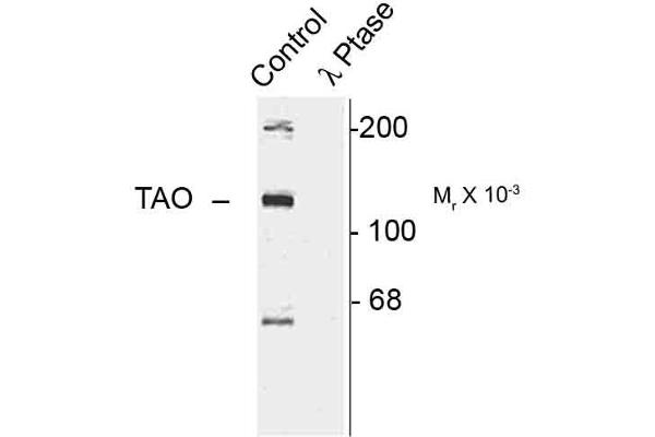 TAO Kinase 2 anticorps  (pSer181)