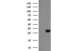 Image no. 1 for anti-Proline Synthetase Co-Transcribed (PROSC) antibody (ABIN1500441) (PROSC anticorps)