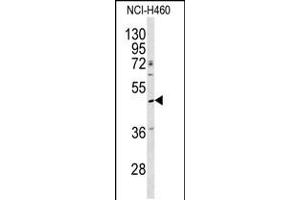 Western blot analysis of SERPINA4 antibody in NCI-H460 cell line lysates (35ug/lane) (SERPINA4 anticorps  (C-Term))