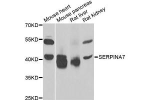 Western blot analysis of extracts of various cell lines, using SERPINA7 antibody. (SERPINA7 anticorps)