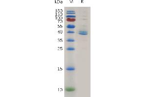 Human TG Protein, hFc Tag on SDS-PAGE under reducing condition. (TGFBR1 Protein (AA 34-126) (Fc Tag))