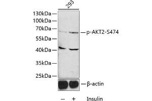 Western blot analysis of extracts of 293 cells, using Phospho--S474 antibody (ABIN3023507, ABIN3023508, ABIN3023509 and ABIN6225357) 1:1000 dilution. (AKT2 anticorps  (pSer474))