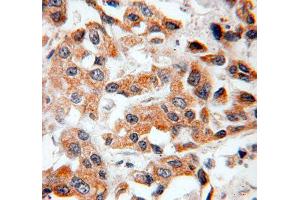 Immunohistochemistry (IHC) image for anti-B-Cell CLL/lymphoma 2 (BCL2) antibody (ABIN1876758) (Bcl-2 anticorps)