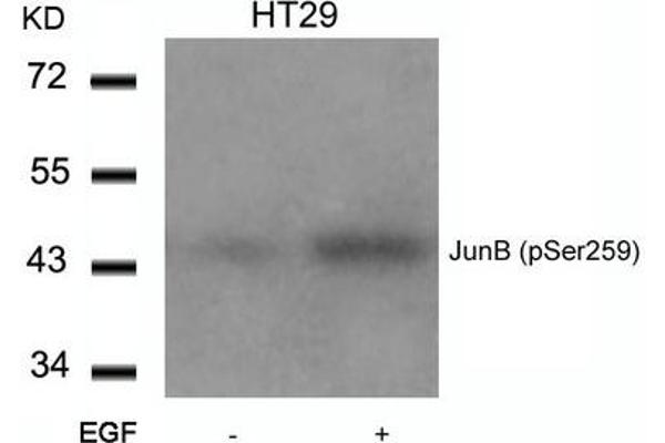 JunB anticorps  (pSer259)