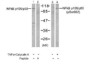 Image no. 2 for anti-Nuclear Factor of kappa Light Polypeptide Gene Enhancer in B-Cells 1 (NFKB1) (Ser932) antibody (ABIN197494) (NFKB1 anticorps  (Ser932))