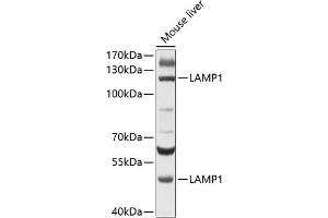 Western blot analysis of extracts of mouse liver, using L antibody (ABIN6130048, ABIN6143079, ABIN6143080 and ABIN6215226) at 1:500 dilution. (LAMP1 anticorps  (AA 80-280))