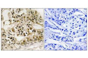 Immunohistochemistry (IHC) image for anti-V-Myb Myeloblastosis Viral Oncogene Homolog (Avian) (MYB) (pSer532) antibody (ABIN1847796) (MYB anticorps  (pSer532))