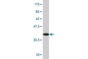 Western Blot detection against Immunogen (38. (JNK anticorps  (AA 318-427))