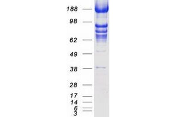 TACC3 Protein (Myc-DYKDDDDK Tag)