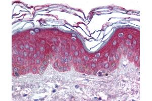 Anti-ARHGEF11 antibody IHC of human skin. (ARHGEF11 anticorps  (AA 1-50))