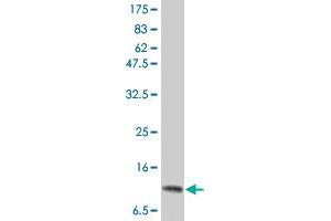 Western Blot detection against Immunogen (15. (IL-2 anticorps  (AA 21-153))