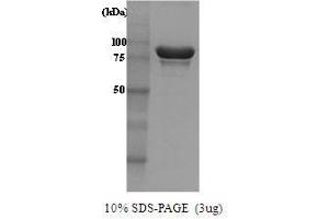 Figure annotation denotes ug of protein loaded and % gel used. (HSP104 Protein (AA 1-908))