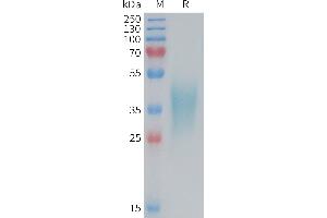 Mouse TNFB Protein, His Tag on SDS-PAGE under reducing condition. (TNFRSF1B Protein (AA 23-258) (His tag))
