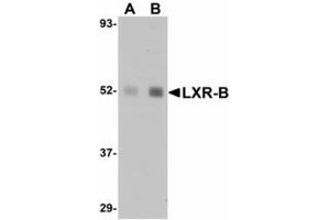 Image no. 1 for anti-Nuclear Receptor Subfamily 1, Group H, Member 2 (NR1H2) (N-Term) antibody (ABIN478107) (NR1H2 anticorps  (N-Term))