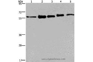 Western blot analysis of MCF-7, 293T, A549, Hela and HepG2 cell, using HNRNPL Polyclonal Antibody at dilution of 1:450 (HNRNPL anticorps)