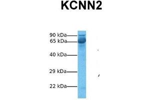 Host:  Rabbit  Target Name:  KCNN2  Sample Tissue:  Human Fetal Liver  Antibody Dilution:  1. (KCNN2 anticorps  (C-Term))