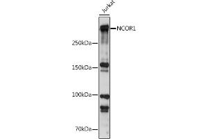 Western blot analysis of extracts of Jurkat cells, using NCOR1 antibody (ABIN6130574, ABIN6144420, ABIN6144421 and ABIN6222831) at 1:500 dilution. (NCOR1 anticorps  (AA 1-200))