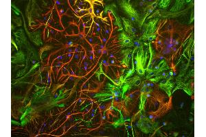 View of mixed neuron/glial cultures stained with Vimentin antibody (green) our our rabbit antibody to GFAP antibody (RPCA-GFAP, red). (Vimentin anticorps)