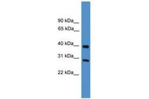 Image no. 1 for anti-Metalloproteinase Inhibitor 2 (TIMP2) (AA 130-179) antibody (ABIN6745438) (TIMP2 anticorps  (AA 130-179))