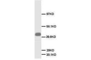 Image no. 2 for anti-Growth Associated Protein 43 (GAP43) (N-Term) antibody (ABIN1495047) (GAP43 anticorps  (N-Term))