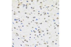 Immunohistochemistry of paraffin-embedded mouse brain using SAFB2 antibody. (SAFB2 anticorps)