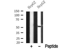 Western blot analysis of NDR1/2 in lysates of HepG2? (NDR1/2 anticorps)