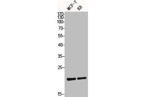 Western Blot analysis of MCF7 KB cells using Bax Polyclonal Antibody (BAX anticorps  (N-Term))