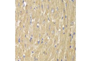 Immunohistochemistry of paraffin-embedded mouse heart using NCF2 antibody (ABIN5970524) at dilution of 1/100 (40x lens). (NCF2 anticorps)